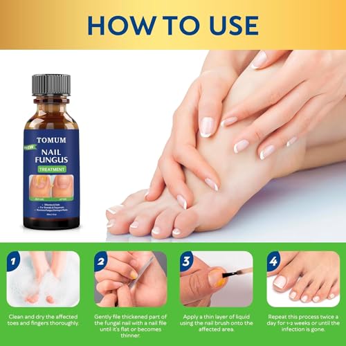 Toenail Fungus Treatment Extra Strength 30 ml P496